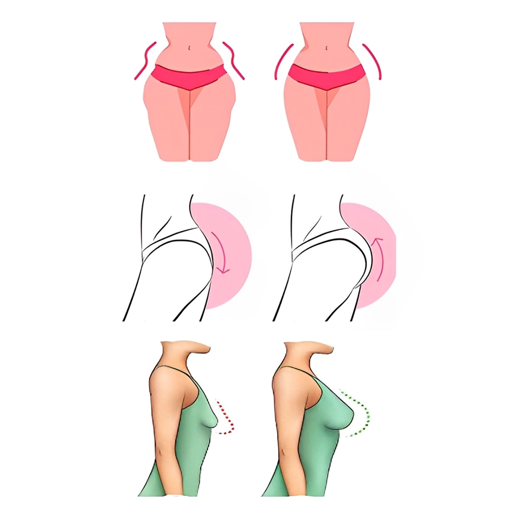 فیلر بدن چیست