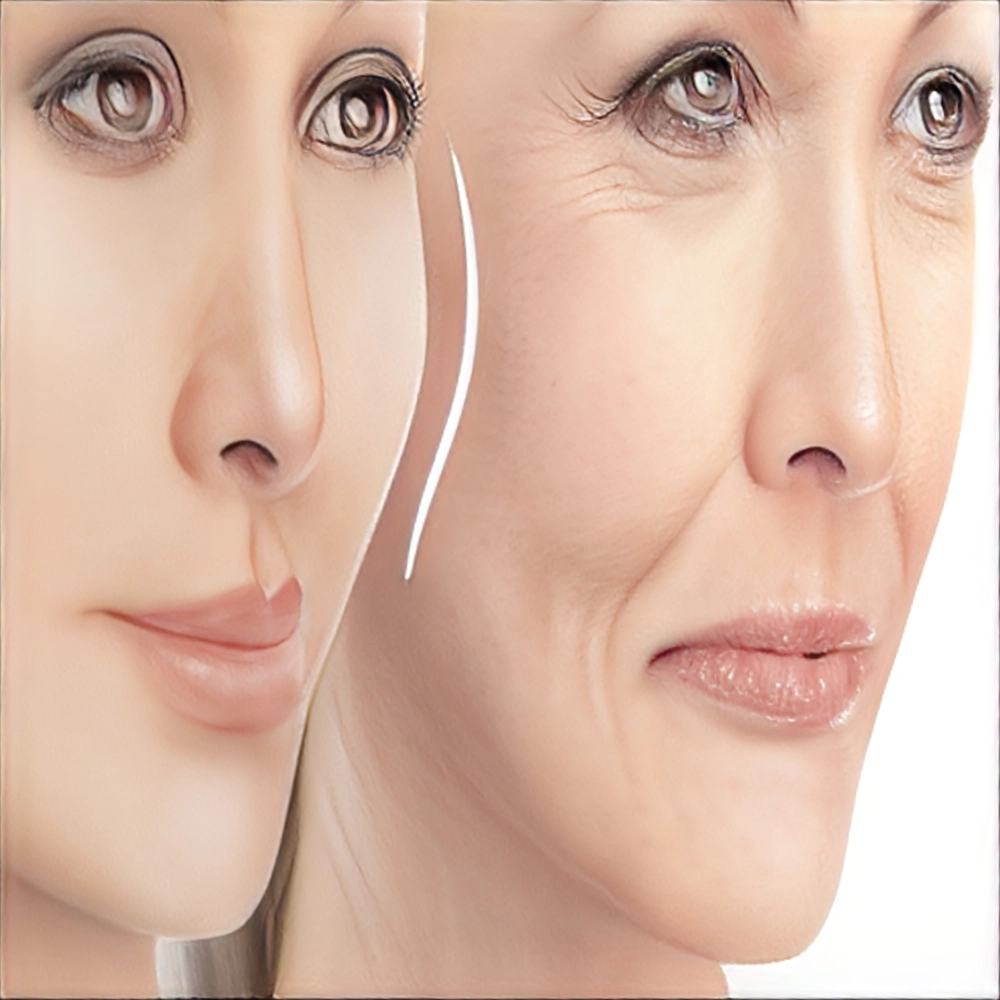 تفاوت تزریق چربی با تزریق فیلر