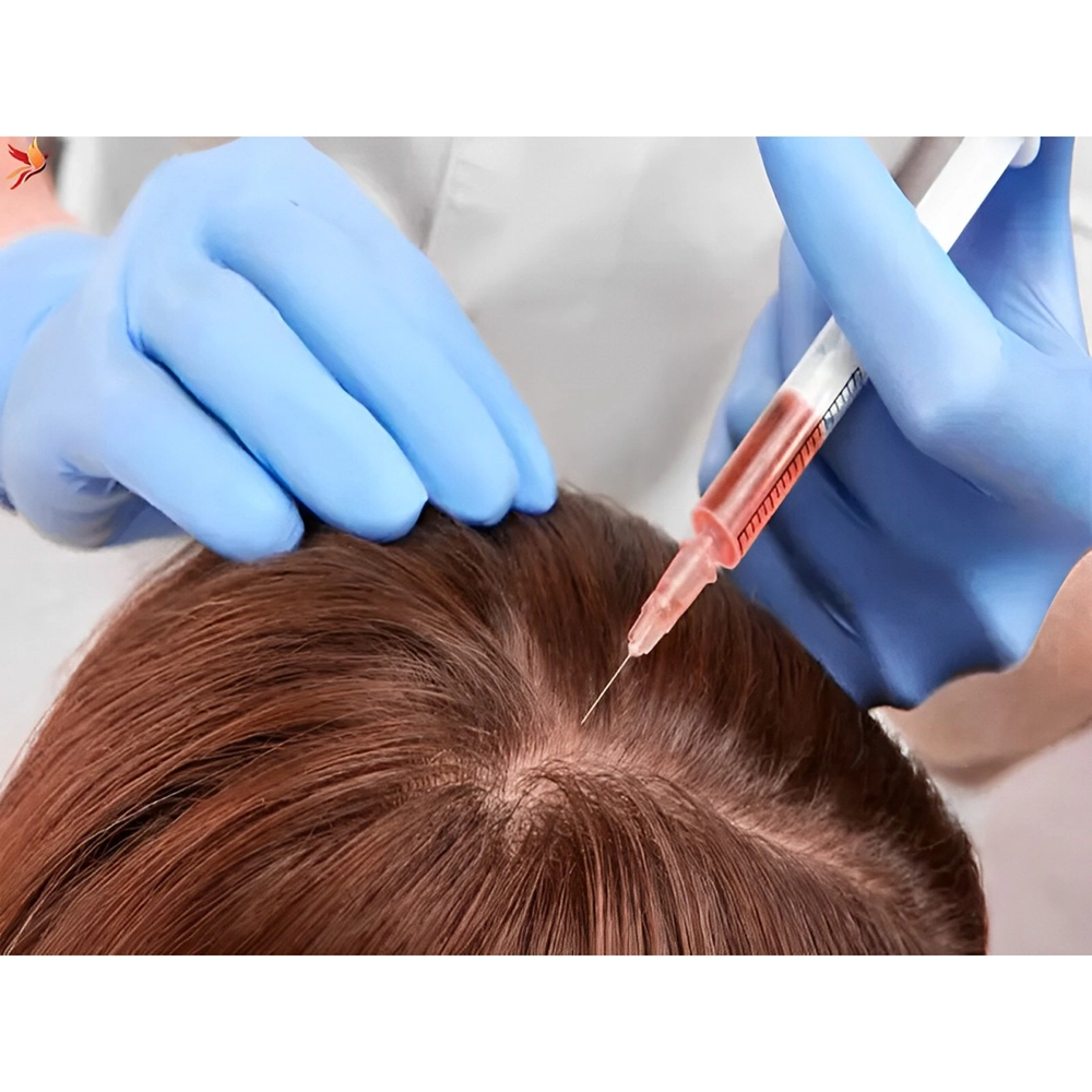 ماندگاری هیر فیلر چقدر است