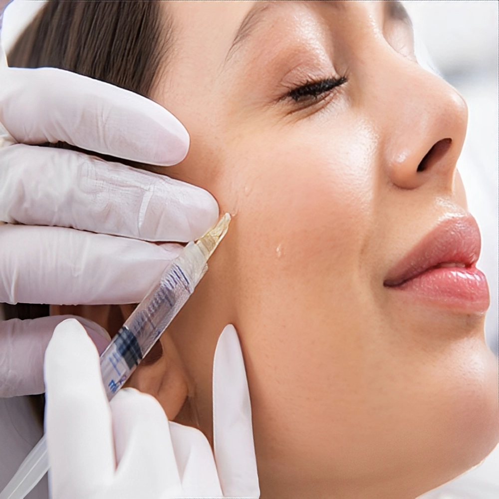 تزریق فیلر به گونه