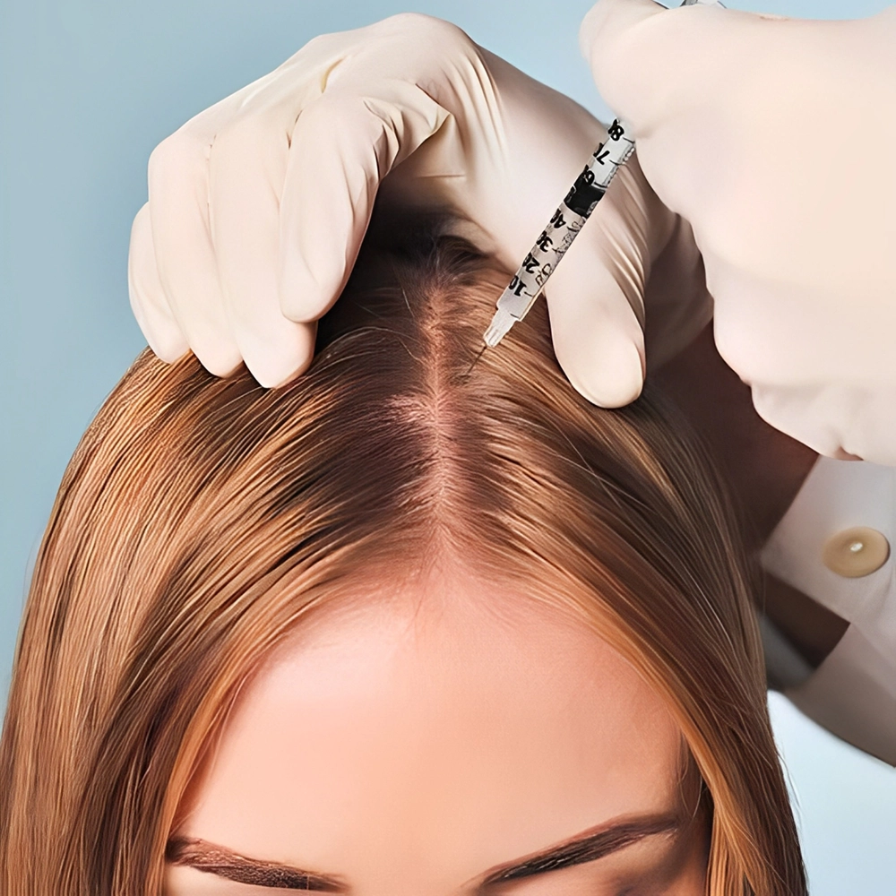 بهترین زمان تزریق هیر فیلر بعد از کاشت مو