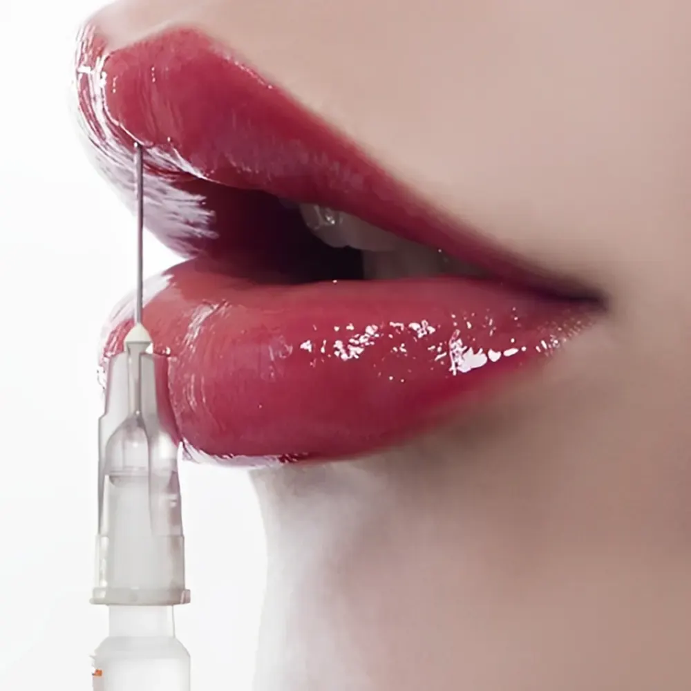 بعد از تزريق ژل به لب چند روز تورم دارد