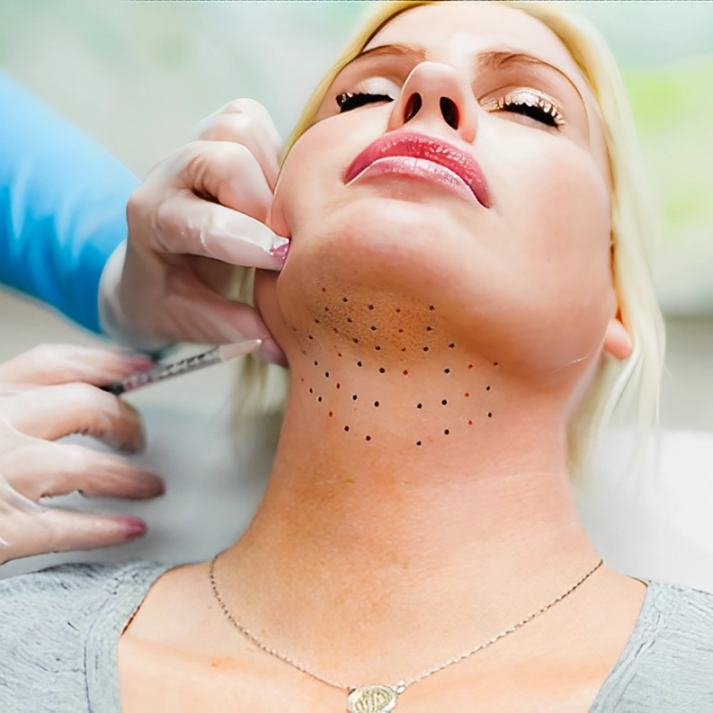 عکس قبل و بعد مزوتراپی غبغب