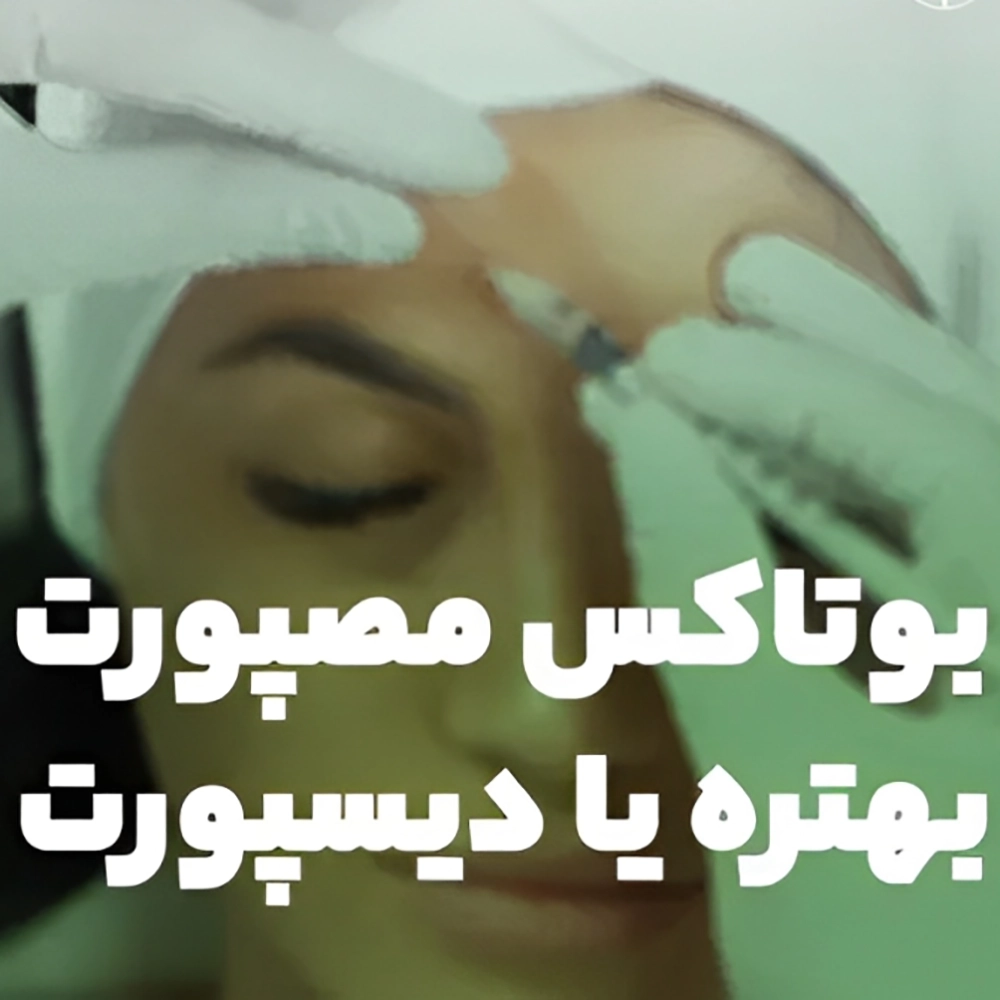 تفاوت بوتاکس مصپورت و دیسپورت