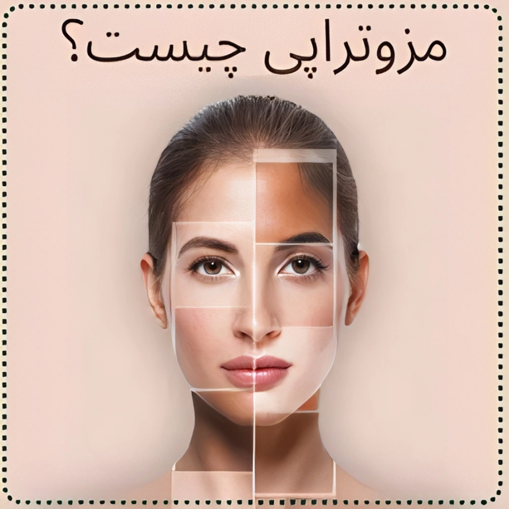 مزو تراپي چيست