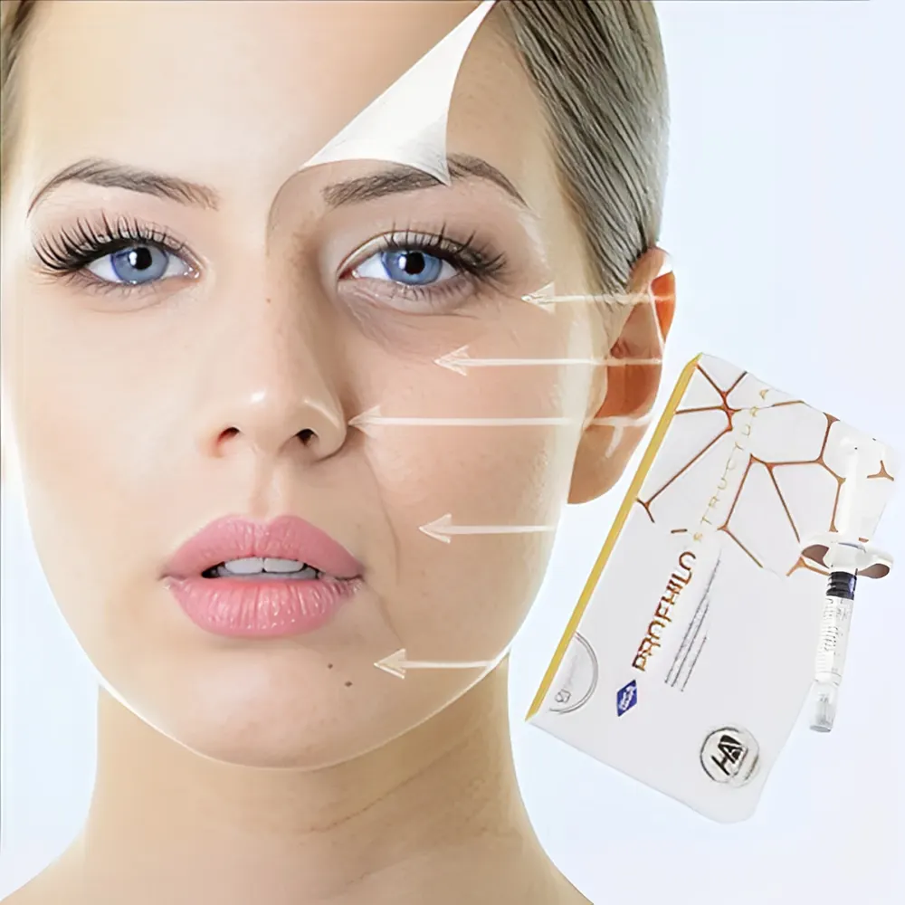 نحوه تزریق پروفایلو استراکچرا