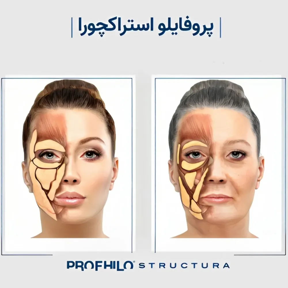 پروفایلو استراکچرا چیست