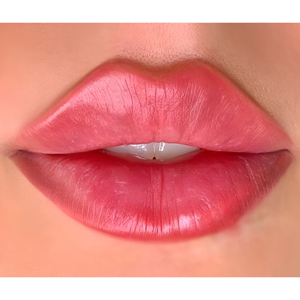 فیلر لب طبیعی : راز لب‌ های جذاب بدون مصنوعی بودن