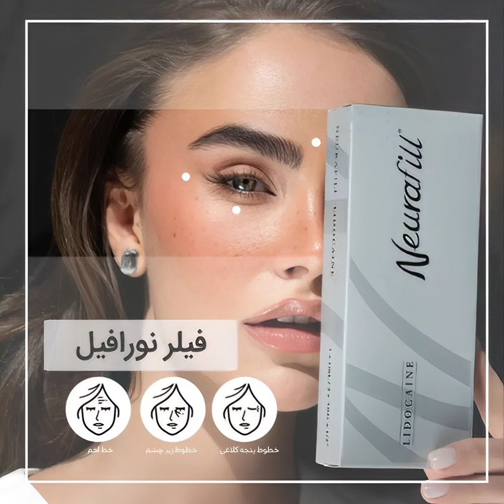 فیلر نورافیل چیست